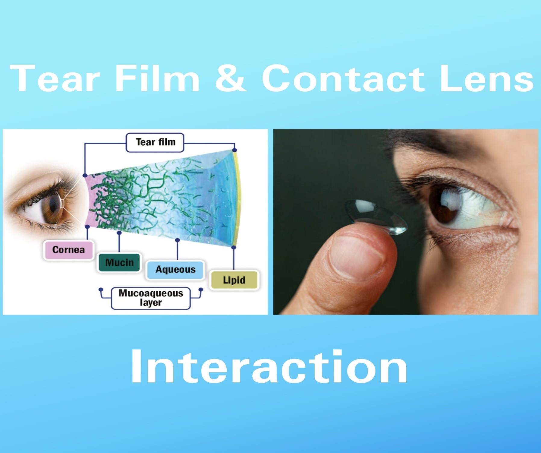 Paragraaf raken stel voor Tear Film & Contact Lens Interaction - Optography