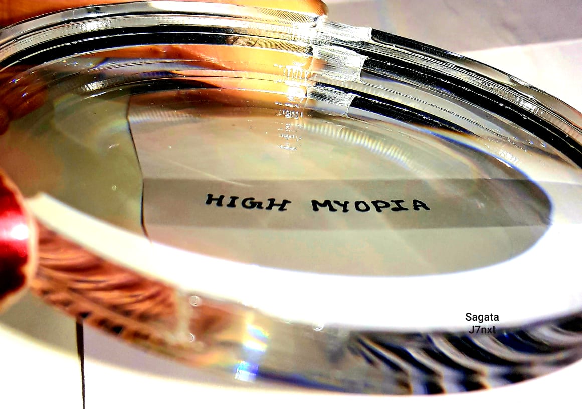 HIGH MYOPIA AND SPECTACLE LENSES