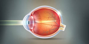 Read more about the article ETIOLOGY OF MYOPIA
