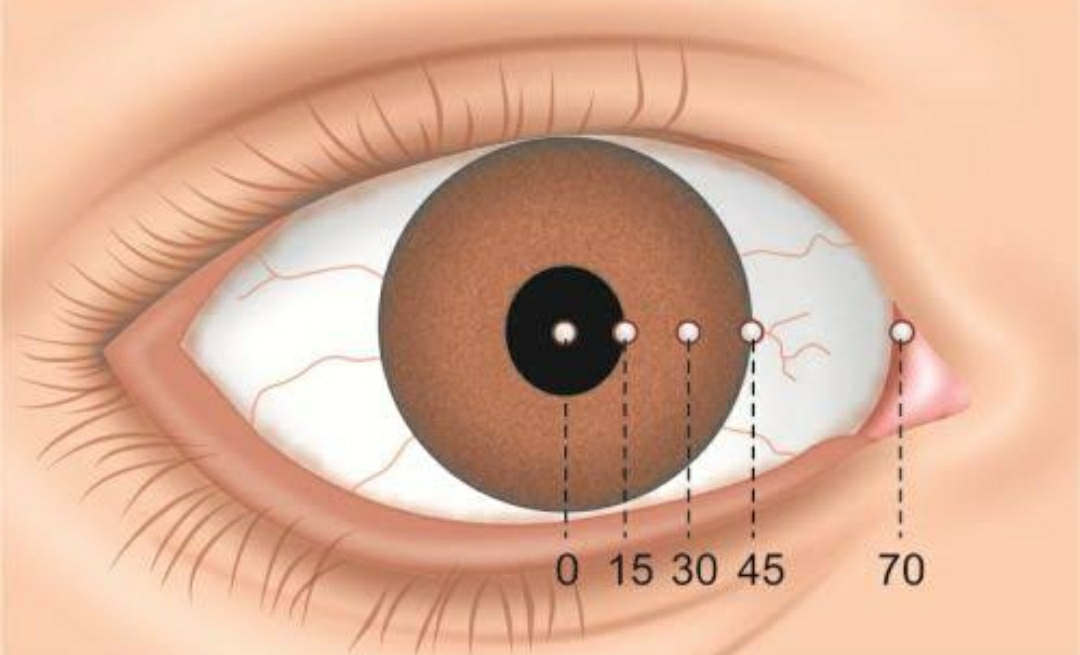 Diplopia (Double Vision) Physiological and pathological - Optography