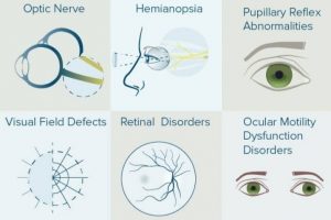 Read more about the article Ocular manifestation of diseases of central nervous system