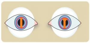 FITTING PROCEDURE FOR RIGID CONTACT LENS - Optography