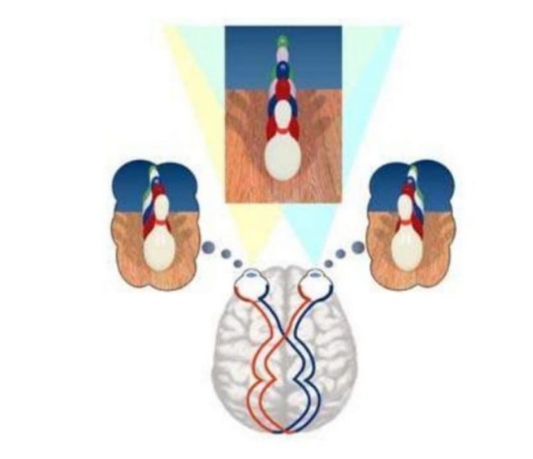 Diplopia (Double Vision) Physiological and pathological - Optography