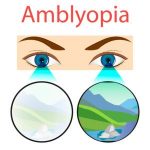 CLASSIFICATION AND TERMOLOGY OF AMBLYOPIA