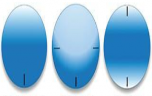 Read more about the article STABILIZATION TECHNIQUES OF  TORIC CONTACT LENS