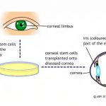 Evolution of low vision management over the decades