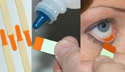 You are currently viewing The different functions of fluorescence stains In eye examination or diagnosis