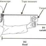 RETINOSCOPY PROCEDURE FOR THE INFANTS