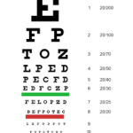 VISION ASSESSMENT FOR PAEDIATRIC