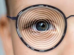 Read more about the article MYOPIA CONTROL STRATEGIES: VISUAL OPTICS PERSPECTIVES