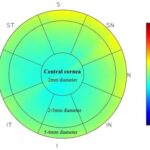 The Critical Role of Central Corneal Thickness in Eye Health