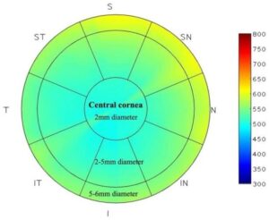 Read more about the article The Critical Role of Central Corneal Thickness in Eye Health