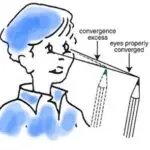 Convergence Excess Picture1