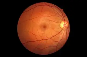 Read more about the article Retinal Imaging: A Window to Early Disease Detection