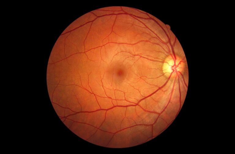 Retinal Imaging: A Window to Early Disease Detection - Optography