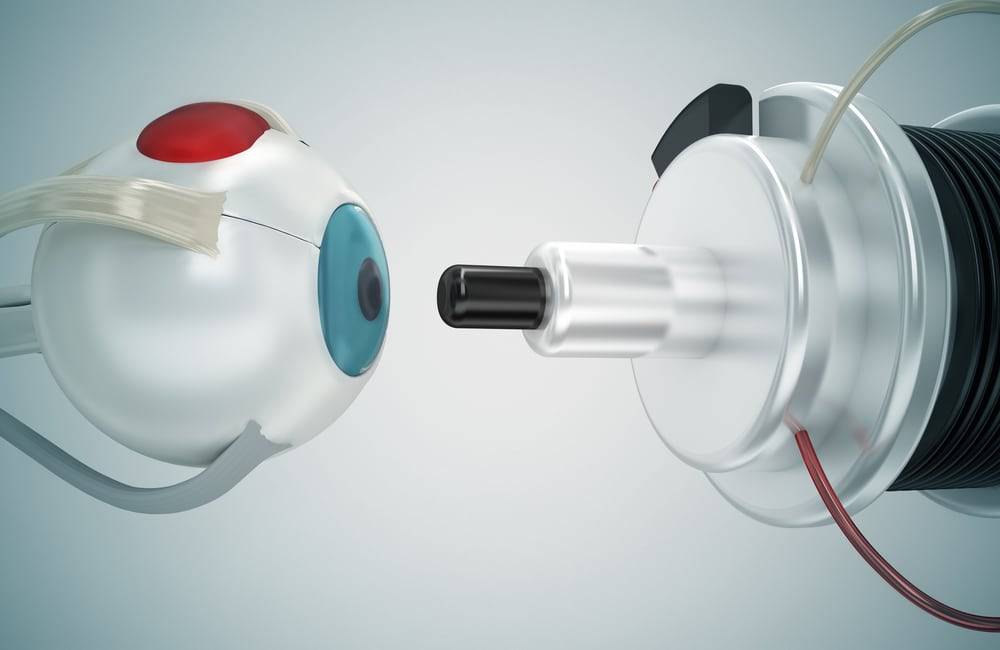 Read more about the article Latest Techniques and Technologies of Cataract Surgeries