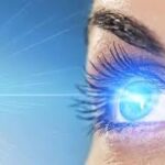 UV ray and Cataractogenesis