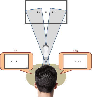 You are currently viewing Binocular Balancing Techniques: Methods and Clinical Importance