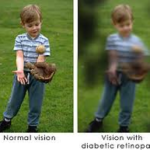 Diabetic retinopathy: early detection and optometrist’s role Picture4