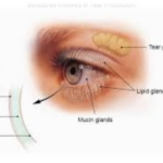 Evaluation and Management of Dry Eye Using Tear Film Biomarkers Picture7