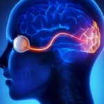 Understanding Cortical Visual Impairment: When the Eyes Work but the Brain Doesn't See Picture8