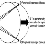 Relative Myopic Defocus: Understanding the Theory