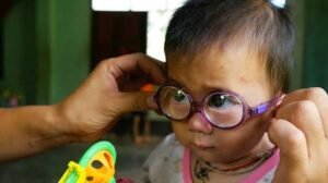 Read more about the article Uncorrected Refractive Errors: A Leading Cause of  Avoidable Vision Impairment